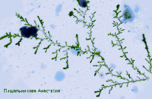 Пищальникова Анастасия. «Водоросли в воде». Изображение лизата эукариотических клеток Микроскоп JEM-1011. 